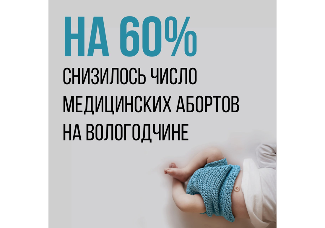 На 60% снизилось число медицинских абортов на Вологодчине.